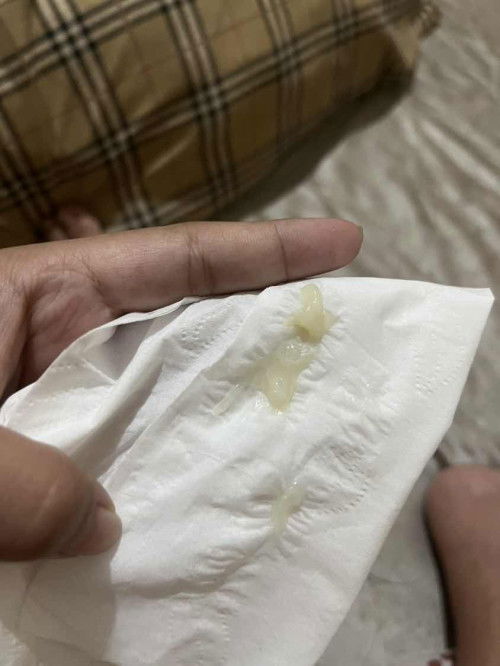 38วีค มีมูกใสออกมาแบบบนี้ค่ะ