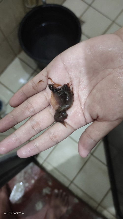 Mucus plug na po ba ito?