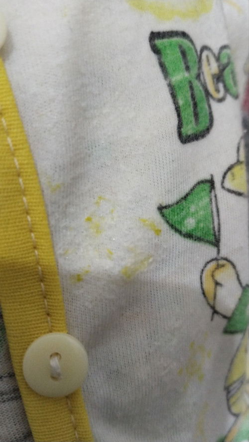 Gumoh bayi ada bercak hijau