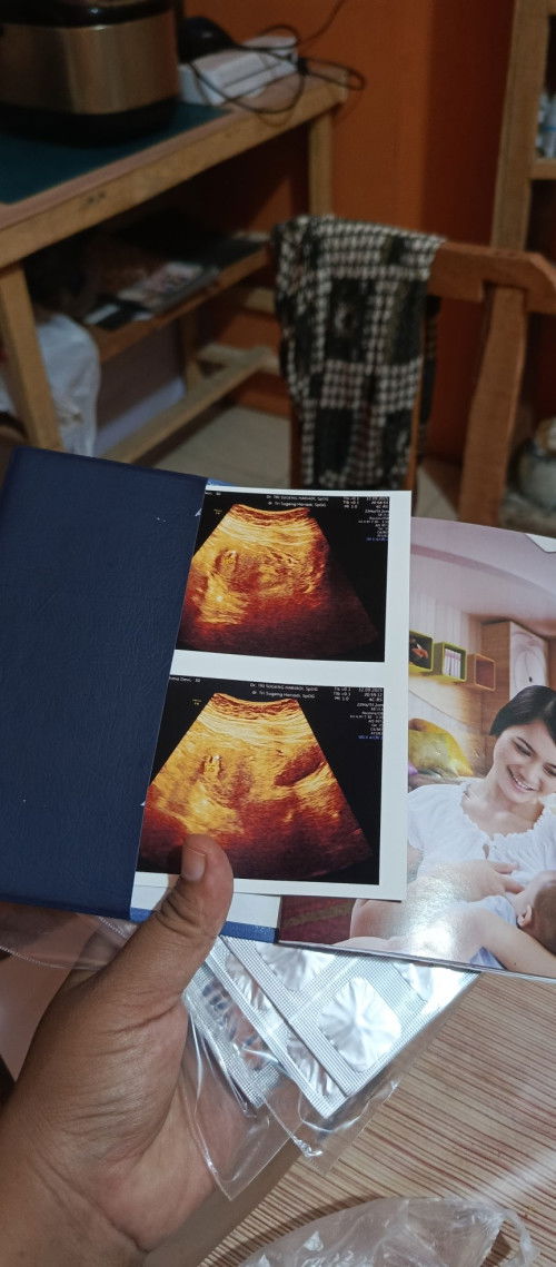 USG baru kelihatan kantung doang