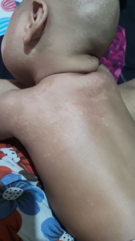 Kulit bayi