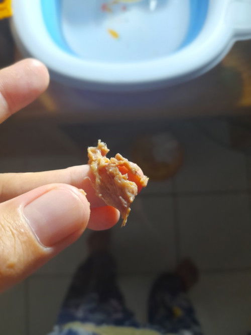 Maaf bun saya sedikit jorok.Saya sudah lahiran secara sc dan sudah 2 bulan.dan skrg keluar kyk gitu