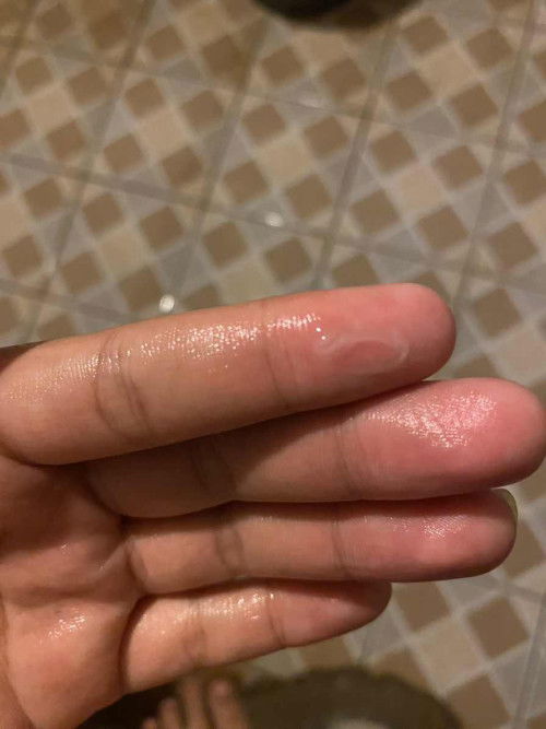 แบบนี้คืออะไรค่ะแม่ๆ