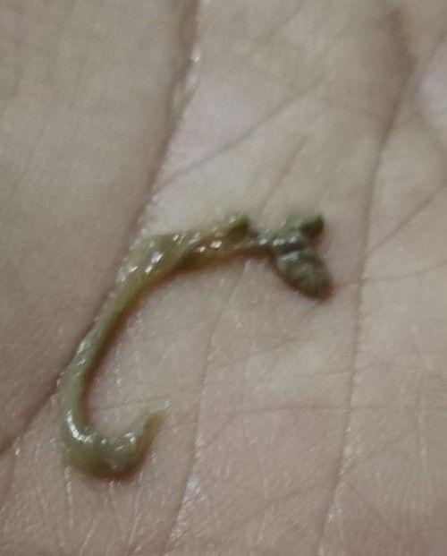 Tanda bersalin