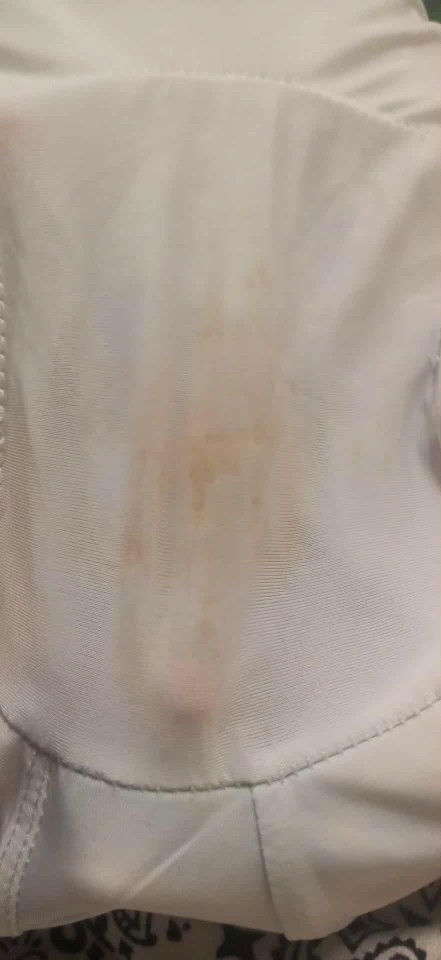 Discharge 11 weeks preggy
