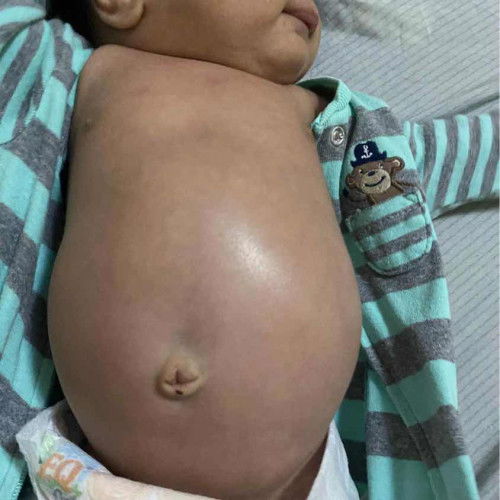 Normal lang ba ang laki ng tiyan ni baby?