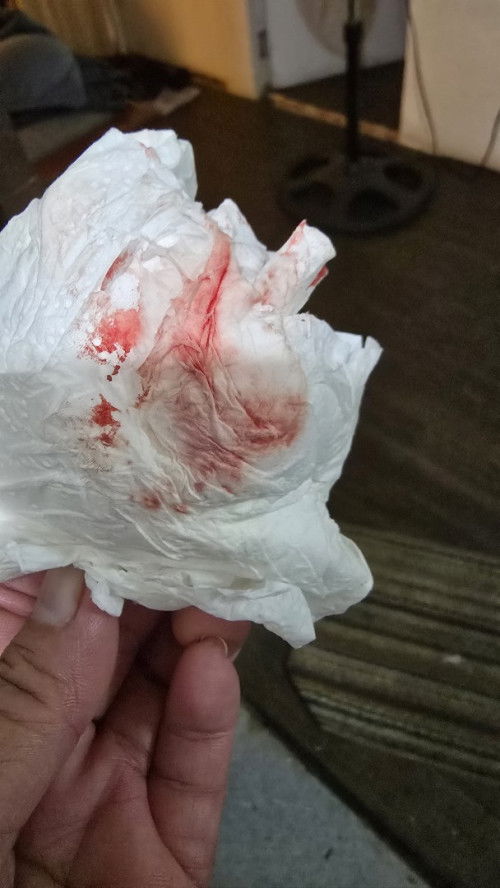 Blood discharge