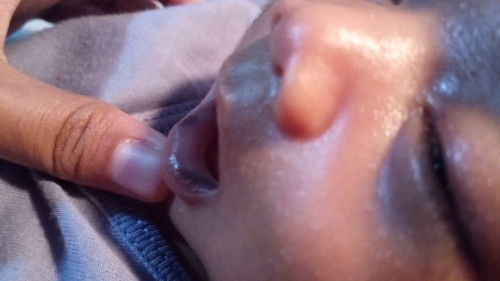 Bun mau tanya klo tiba tiba di bibir dalam bayi ada hitam hitamnya apakah bahaya bun?