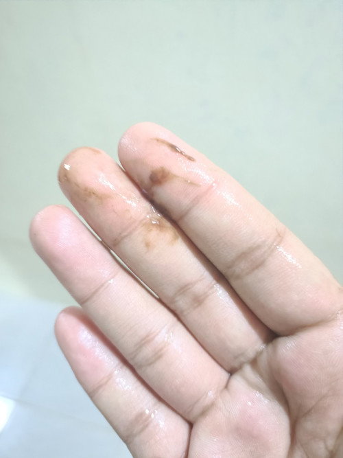 Bun USG trakhir di hol trakhir brapa Minggu yah yng bagus ?