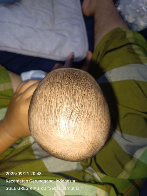 Kepala anak Peyang