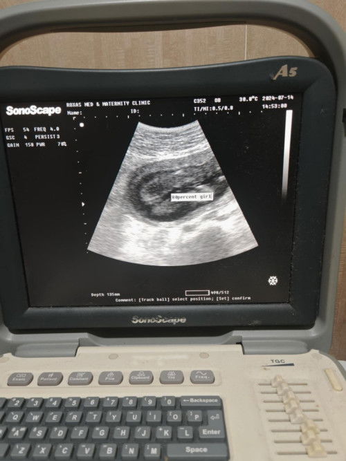 Mga mi sure na kaya results sa ultrasound ko starting nesting na Po Kasi para Kay baby
