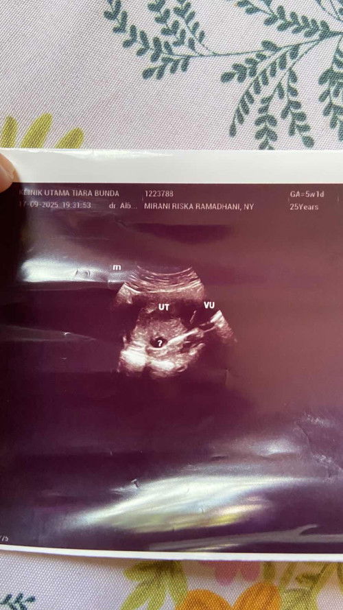 ada yang tau ngga ya bun ini
apa?