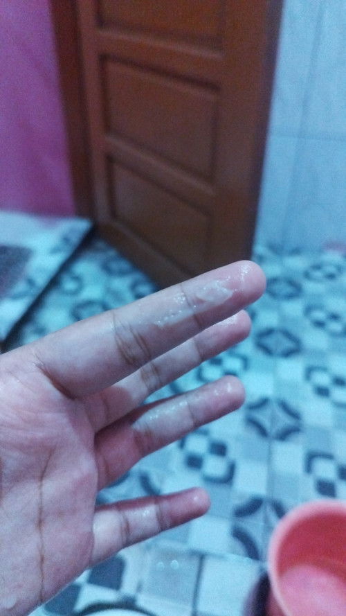 Keluar lendir di 33 week