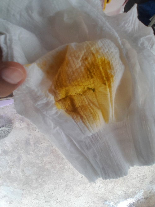 ทารกแฝดวัย1เดือน