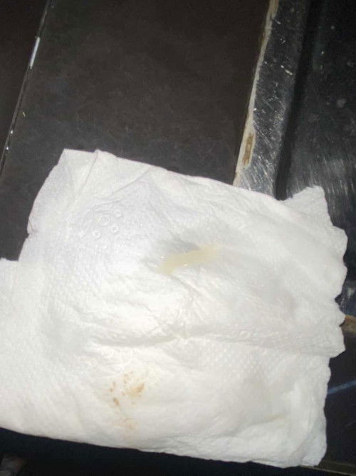 Mucus Plug