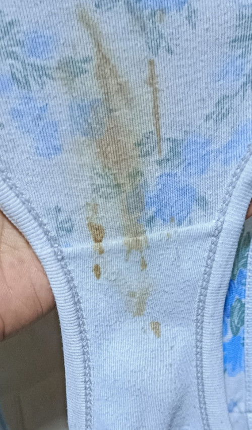 Ano po kaya to? Kahapon po in-IE ako then pagkagising ko ngaung umaga may ganito po sa underwear ko.