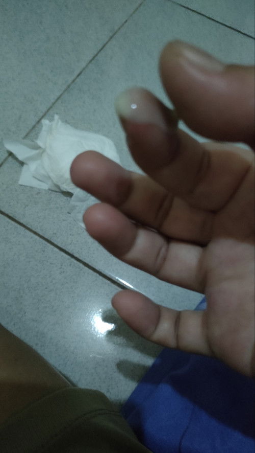 Ketuban/keputihan