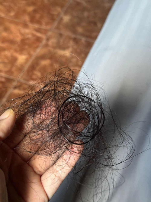 rambut rontok