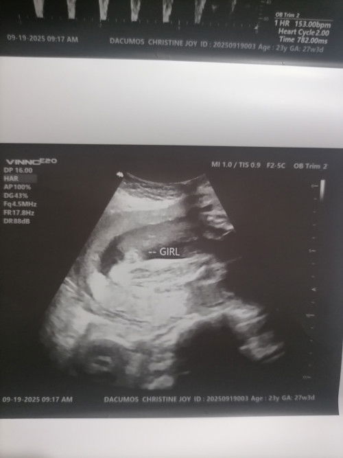 Sure po ba na baby girl mga miii 26 weeks and 4 days po