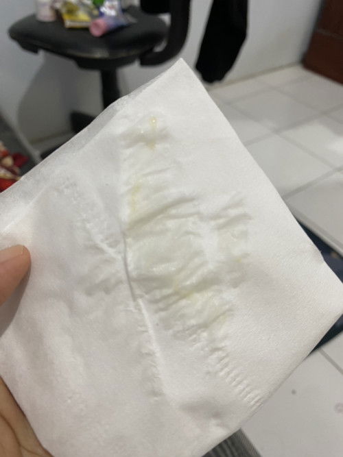 Keputihan saat hamil tm 1