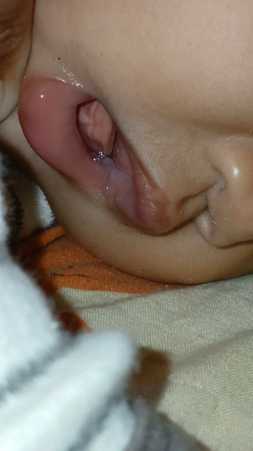 เหงือกมีรูปเหมือนฟัน2ซี่งอแง