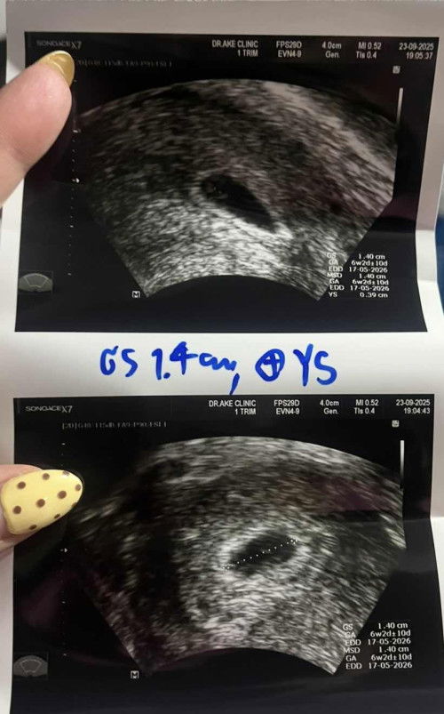 6 week 3 day