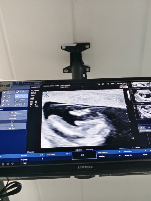 13W+5D เพศลูก