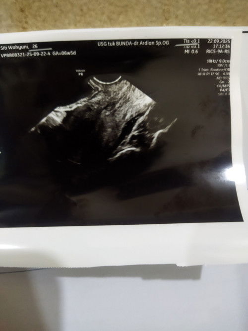 Hamil anak kedua dikasih cobaan