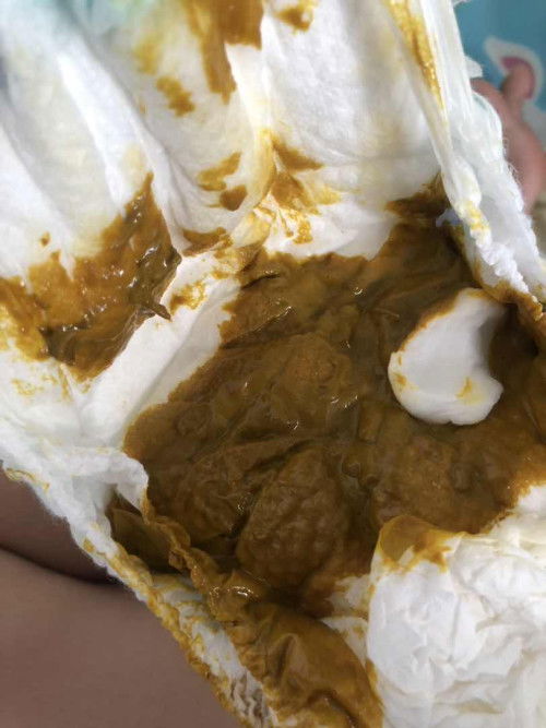 jarang buang air besar bayi 3 bulan