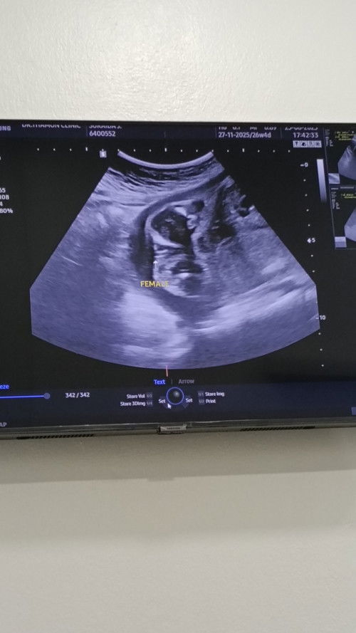 แม่บ้านไหนได้ลูกสาว มาอวดกันหน่อยค่า
ทีมพฤศจิกายน ป้าหมอนัดผ่า วันที่ 13 ค่า 🎀