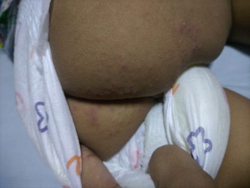 hi mga mii ano po ba ito?natatakot kasi first time mom po ako diko po alam anong cream ipapahid ko
