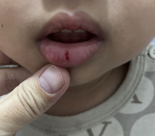 Kebiasaan ngopek bibir 😭