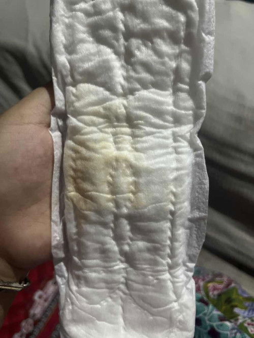 สอบถามหน่อยค่ะตอนนี้ตั้งท้องได้40สัปดาห์2วันนํ้าที่ออกแบบนี้ควรไปหาหมอมั้ยค่ะ#ท้องแรก