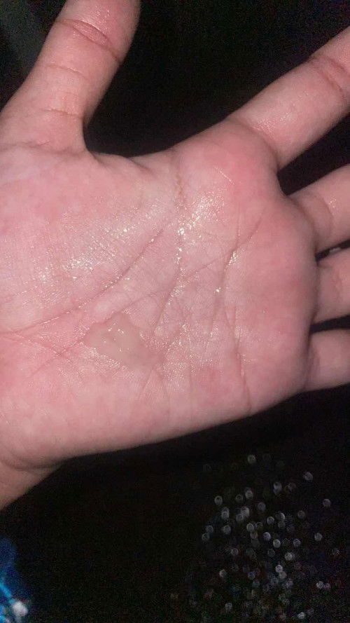 แบบนี้ใกล้คลอดยังค่ะ🥹