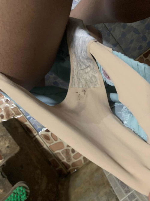 น้ำคร่ำรั่ว/น้ำเดิน