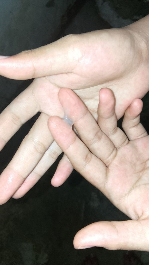 มีมูกใสใสไหลออกมากี่วันถึงคลอดค่ะ