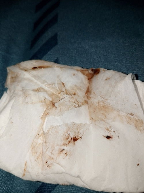 Keluar lendir bercampur darah