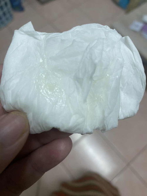 แม่ๆคะ ตอนนี้ 37 วีค+ 1 วัน มีมูกเหลืองๆแบบนี้ค่ะ ไม่คัน แต่ตอนปัสสาวะจะคัดๆนิดหน่อย ท้องแข็งบ้าง แต่ไม่ถี่ ไม่ปวดท้อง