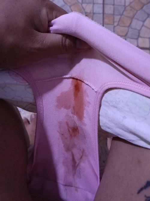 40สัปดาห์มีมูกเลือด