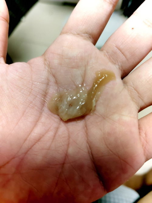 Sino po naka experience nito?