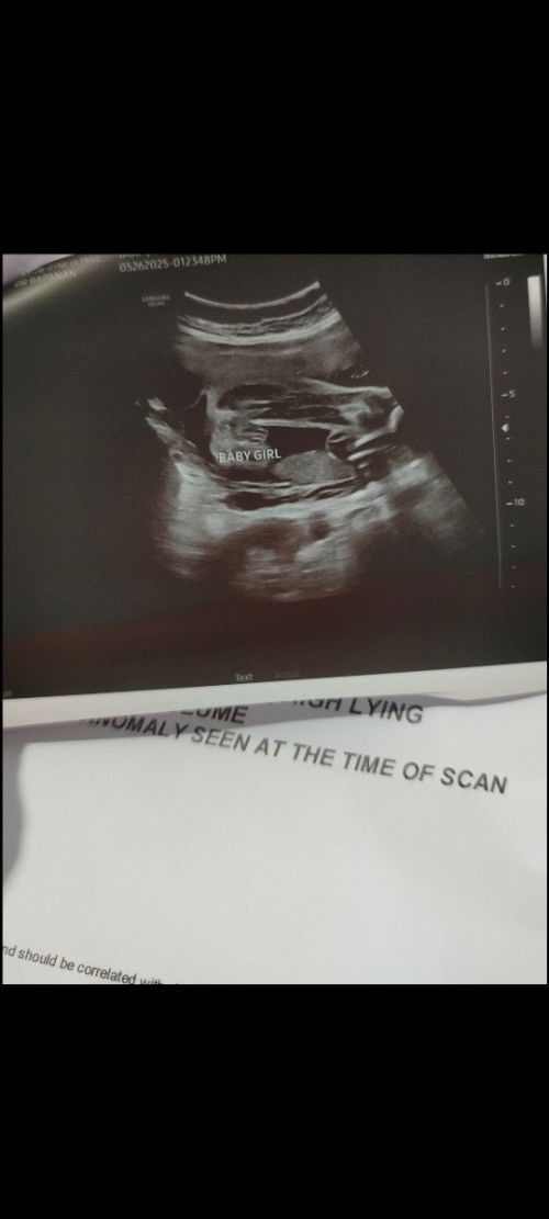 mga mommy, sure na kaya ito na baby girl.? subrang excited na kasi ako...may 2boy na kasi ako