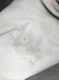 Sino may same case ko dito na 7 months pregnant may gantong discharge para syang jelly walang amoy