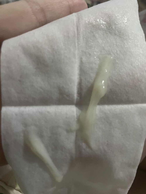 อาการแบบนี้ปกติไหมค่ะ