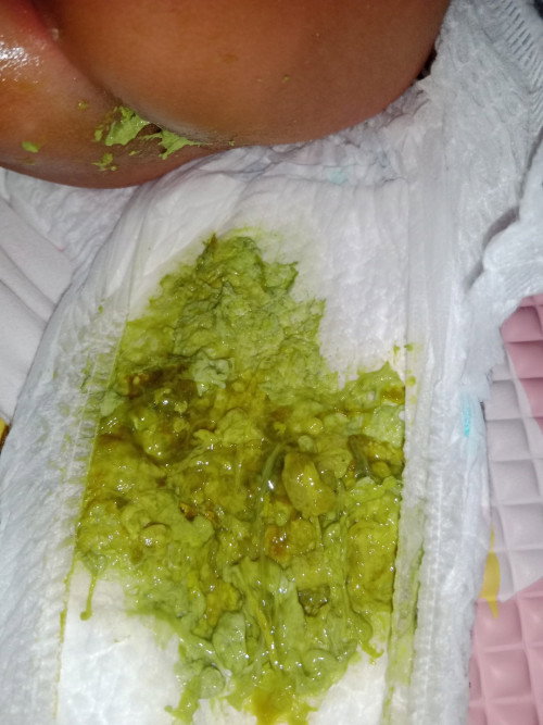 Kenapa ya bun pup anakku kayak gini, maaf kalau agak jorok