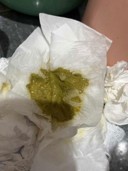 น้องถ่ายสีนี้ผิดปกติไหมคะ