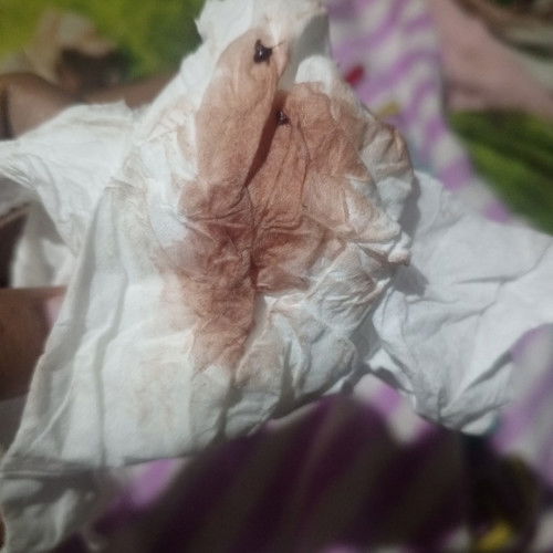 Flek di kehamilan 30 minggu