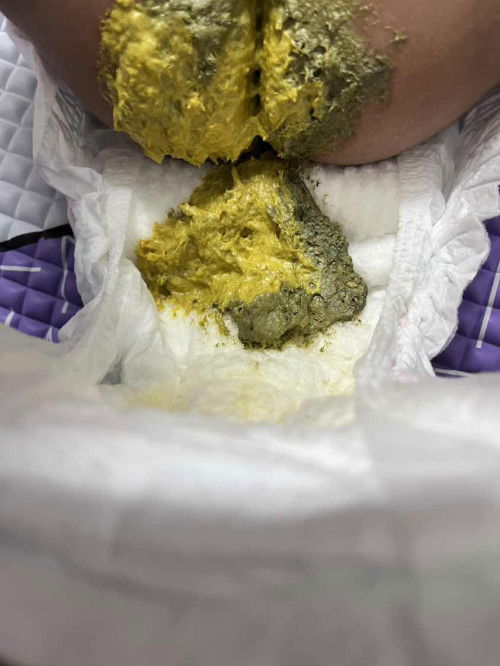 Najis anak minum susu dupro