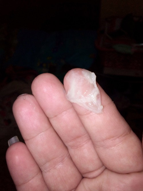 Keluar lendir