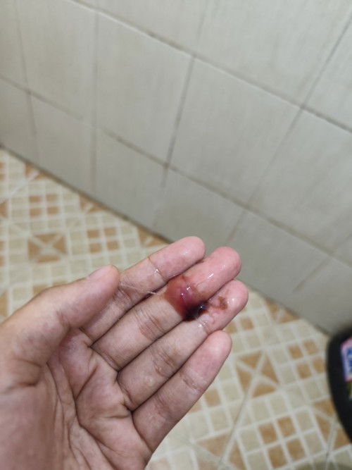 Hamil 39 week keluar flek darah,langsung periksa ke dokter atau nunggu kontraksi intens dulu ya bun?