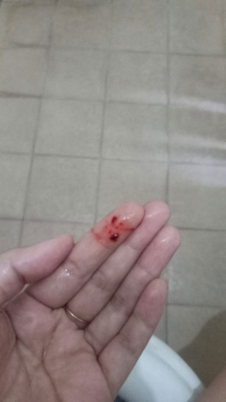 keluar darah di usia kehamilan 6 minggu